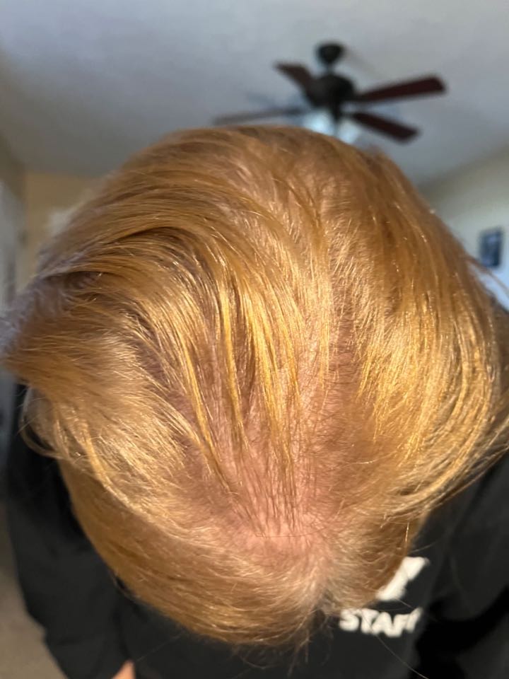 The Hair Topical Solution - Classic review photo by Rhonda J.