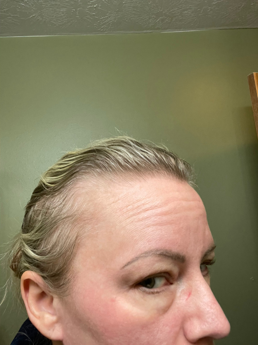The Hair Pill review photo by Amber H.