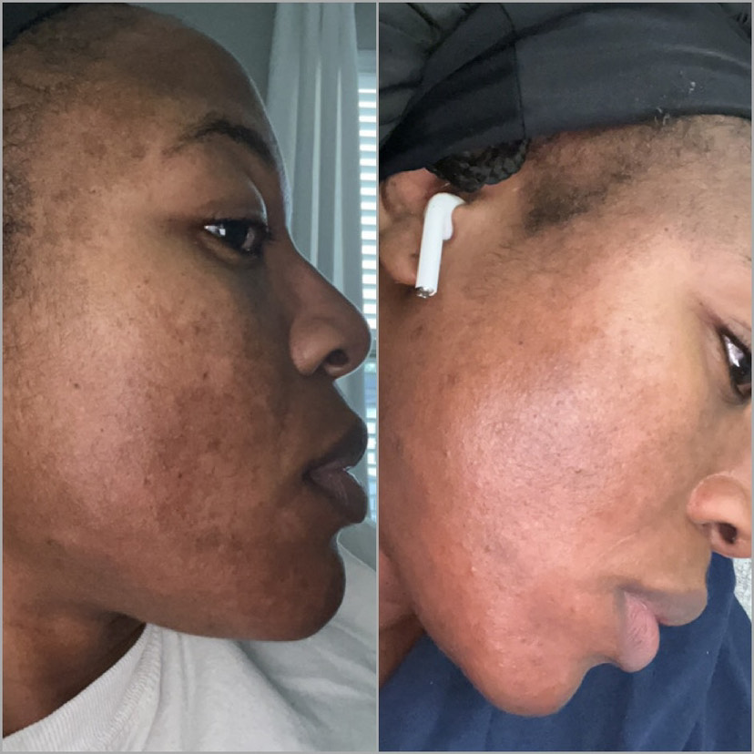 The Anti-Aging Cream review photo by anne E.