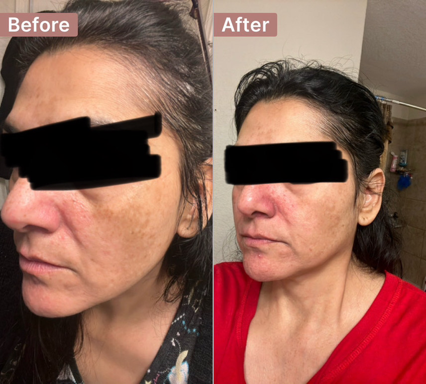 The Spot Cream review photo by Siboney B.