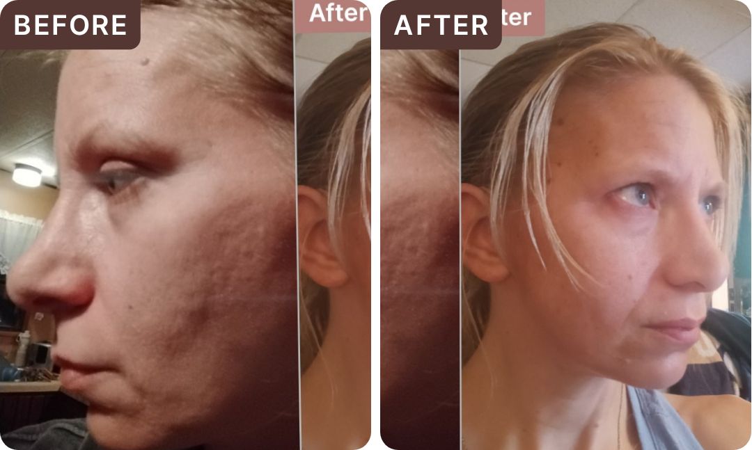 Stephanie C. -- before and after, 8 weeks