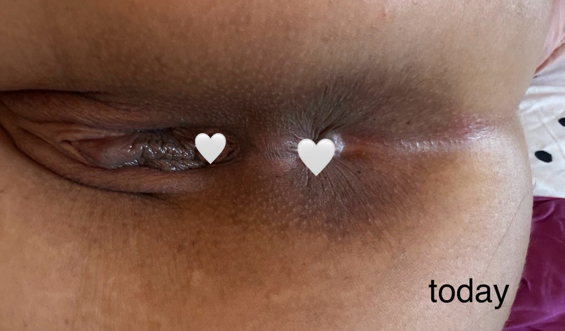 Post attachment 6