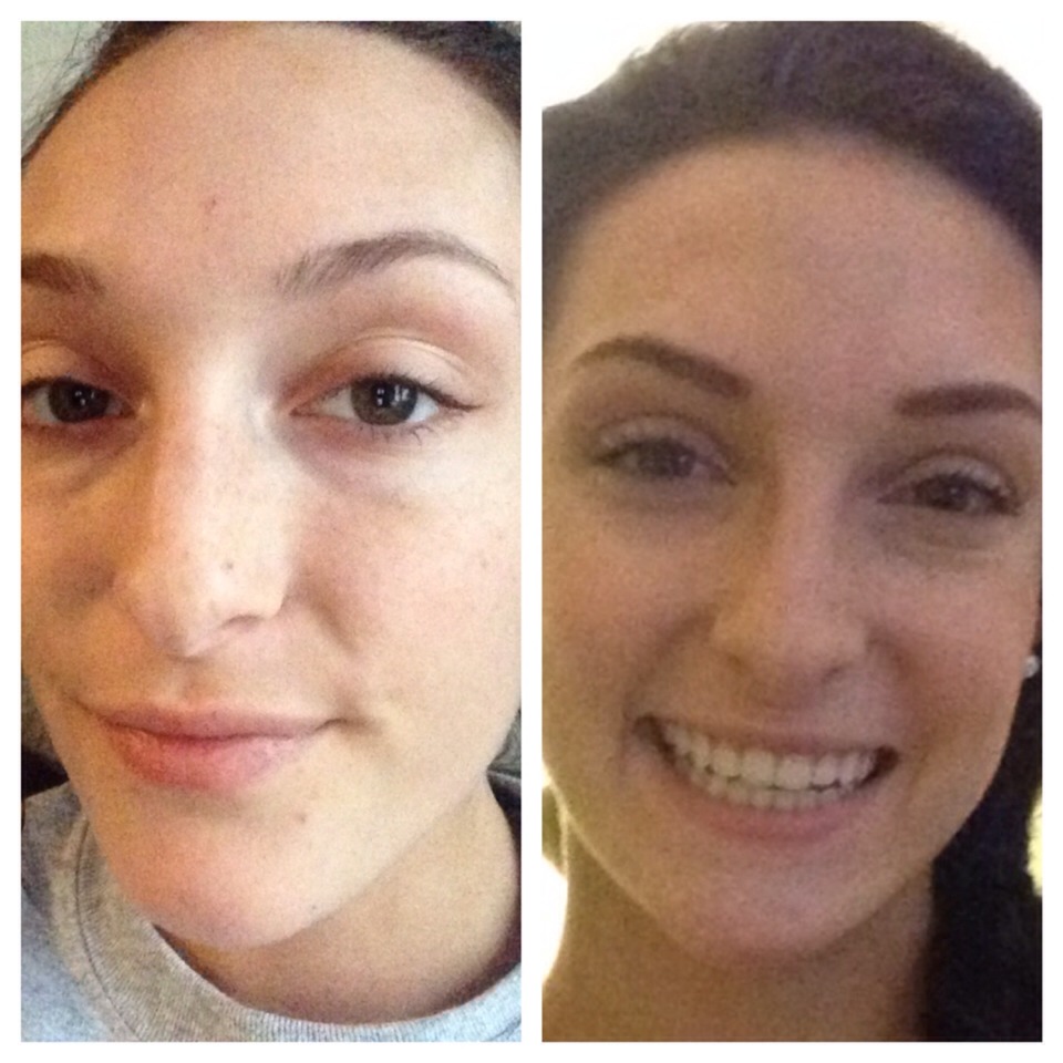 Taking These Two Vitamins Drastically Improves Skin And Metabolism