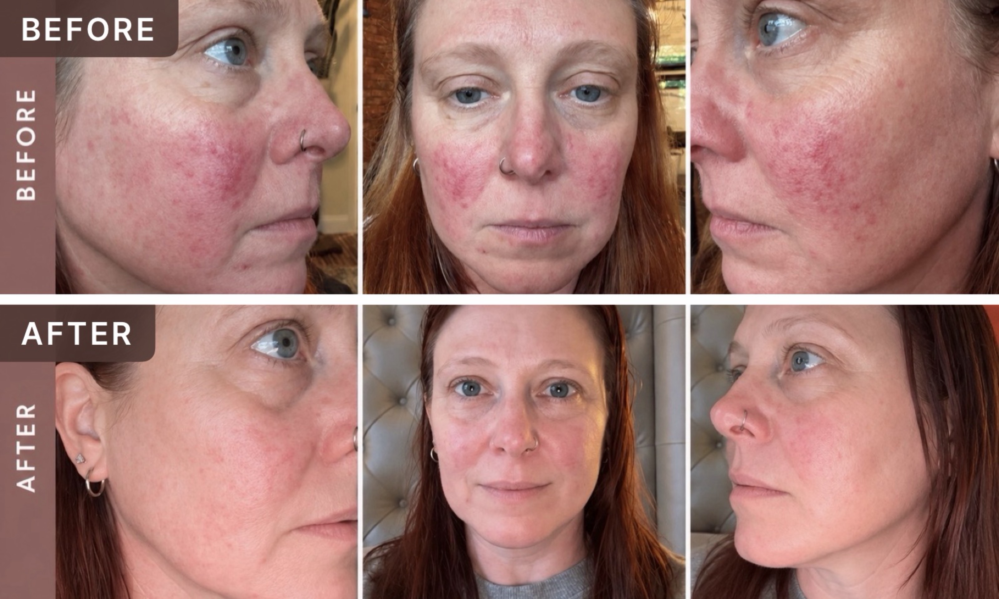 Amy G. -- before and after, 8 weeks