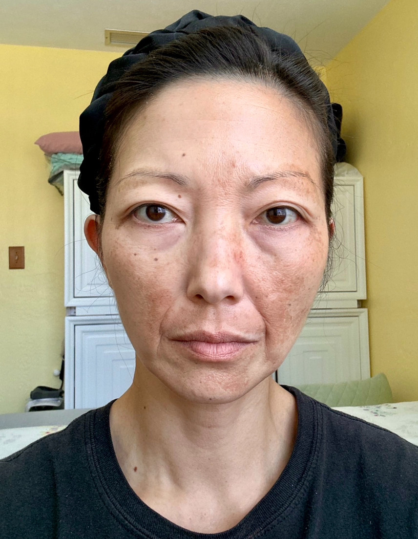 No More Bullying By Co workers Skin Journey MuselyWorks no-more-bullying-by-co-workers-skin-journey-muselyworks