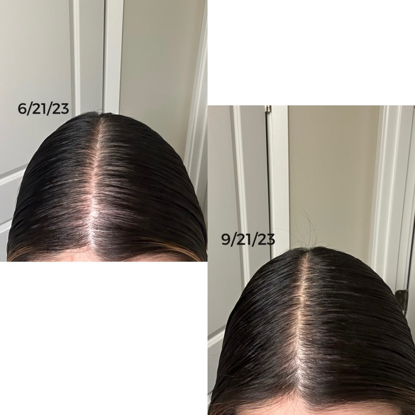 The Hair Topical Solution - Classic review photo by Alissa G.