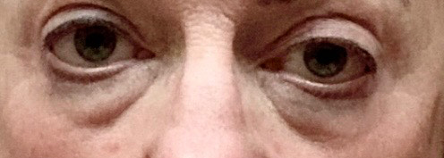The Eye Serum review photo by Rebecca M.