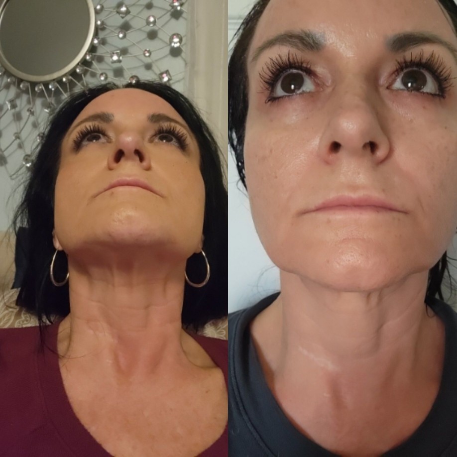 Customer photo