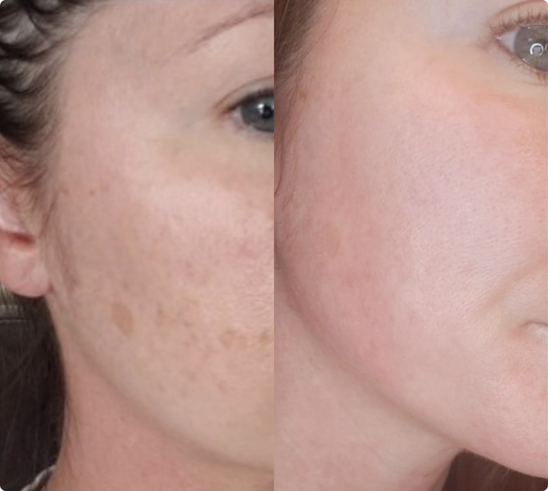 Before and after review photo