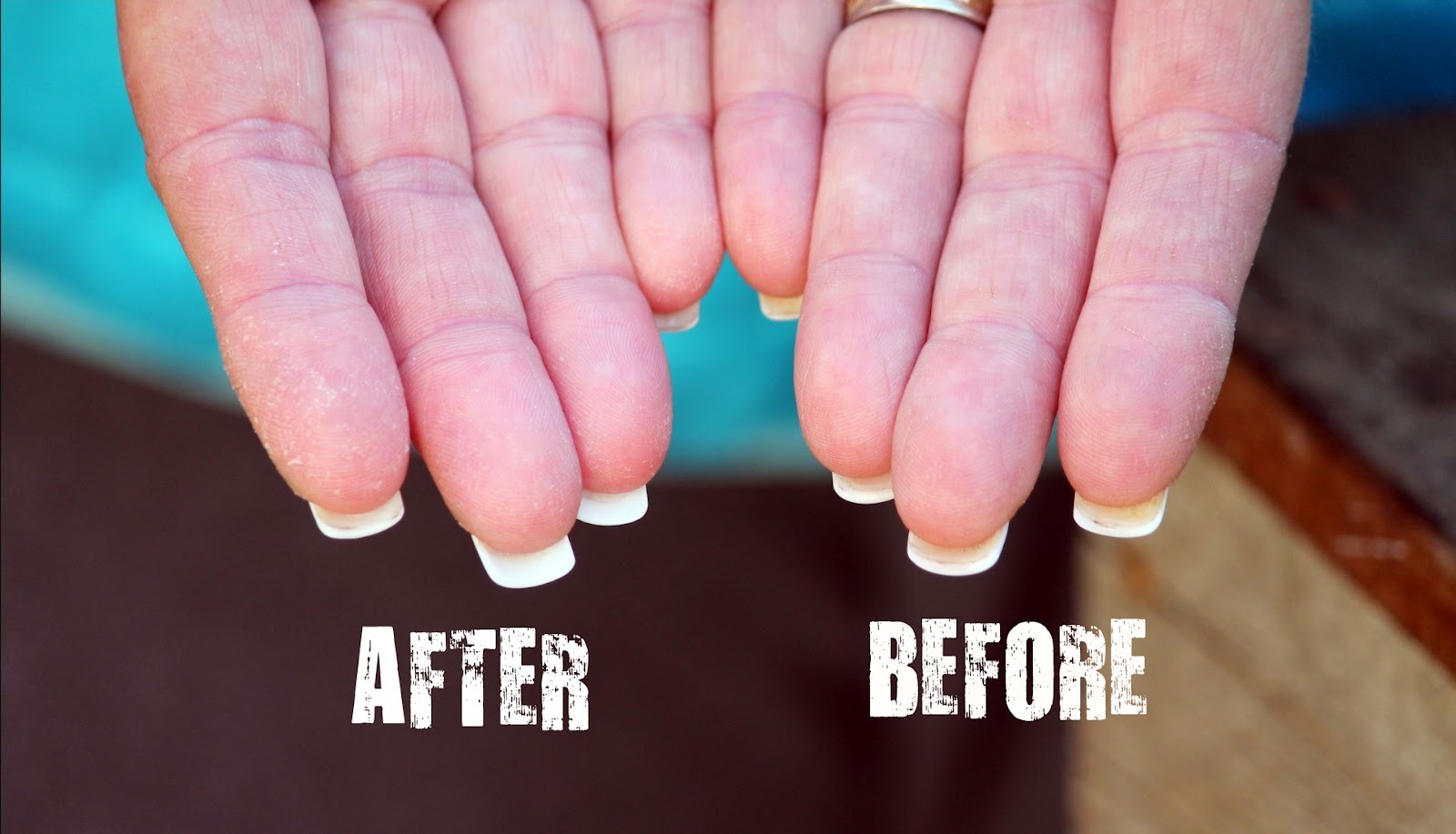 Clean Nail (before And After) Musely