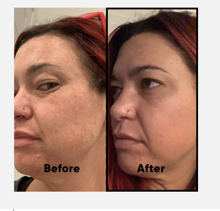 The Spot Cream review photo by Aimee M.