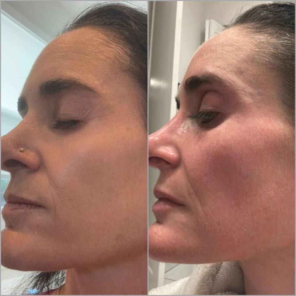 Customer photo