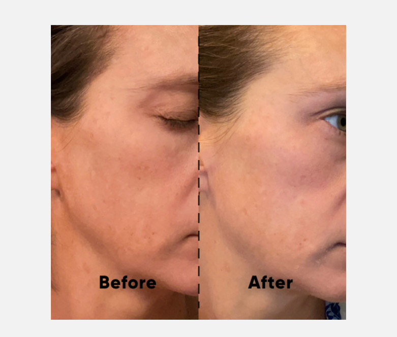The Spot Cream review photo by Krystal P.