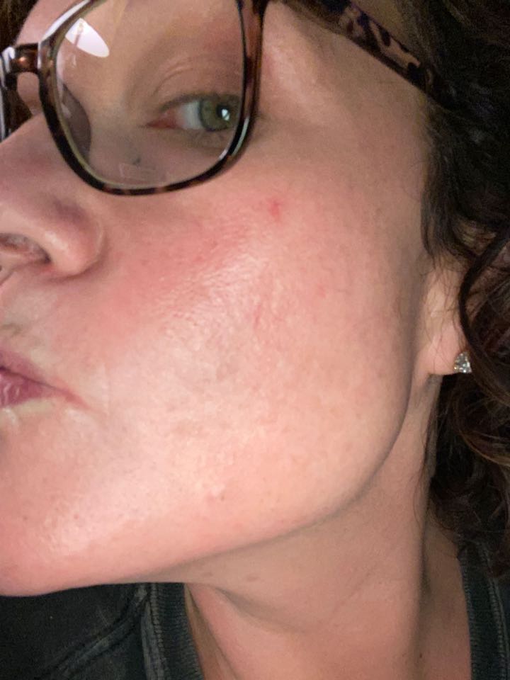 The Spot Cream review photo by Angela S.