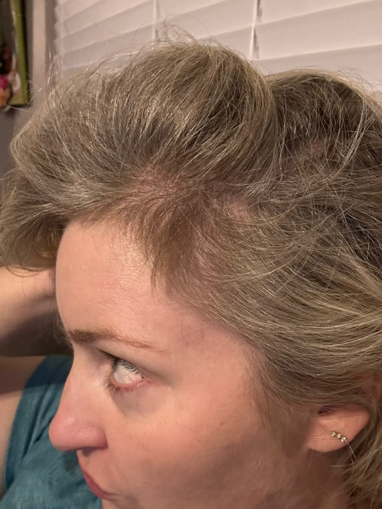 The Hair Pill review photo by Nicole H.