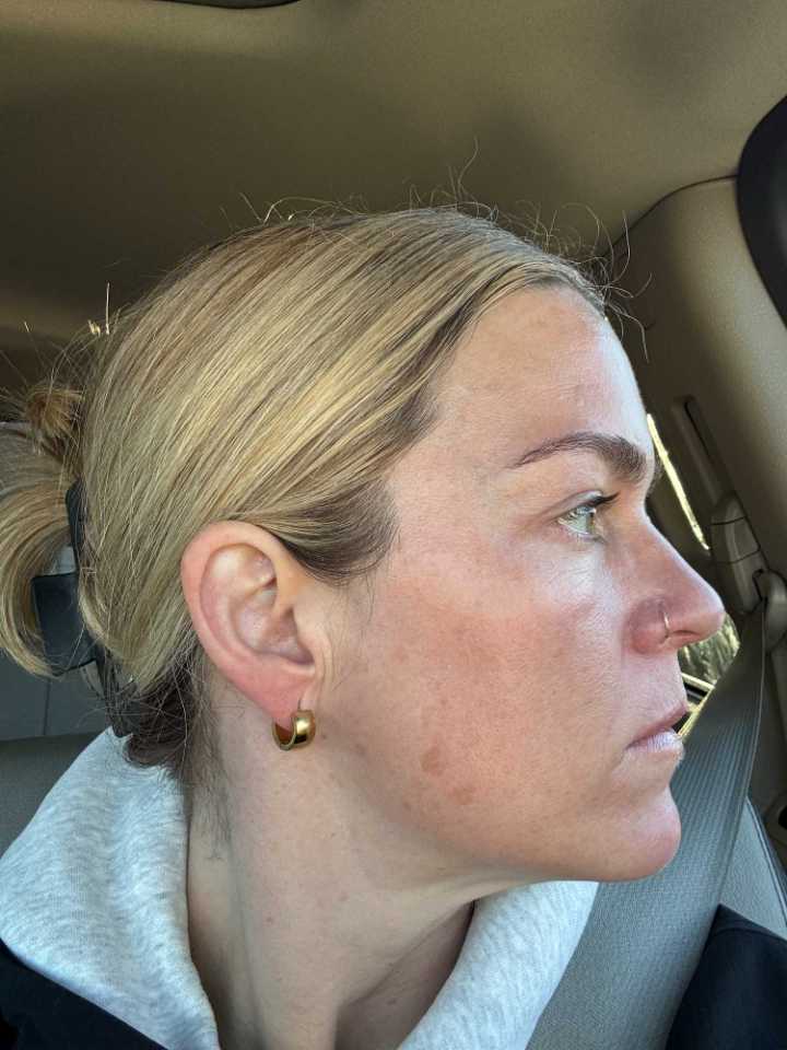 The Spot Peel review photo by SKPD D.