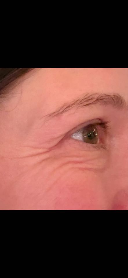 The Eye Serum review photo by Lauren A.