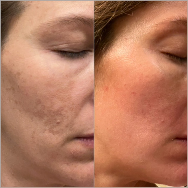 The Spot Cream review photo by Laine H.