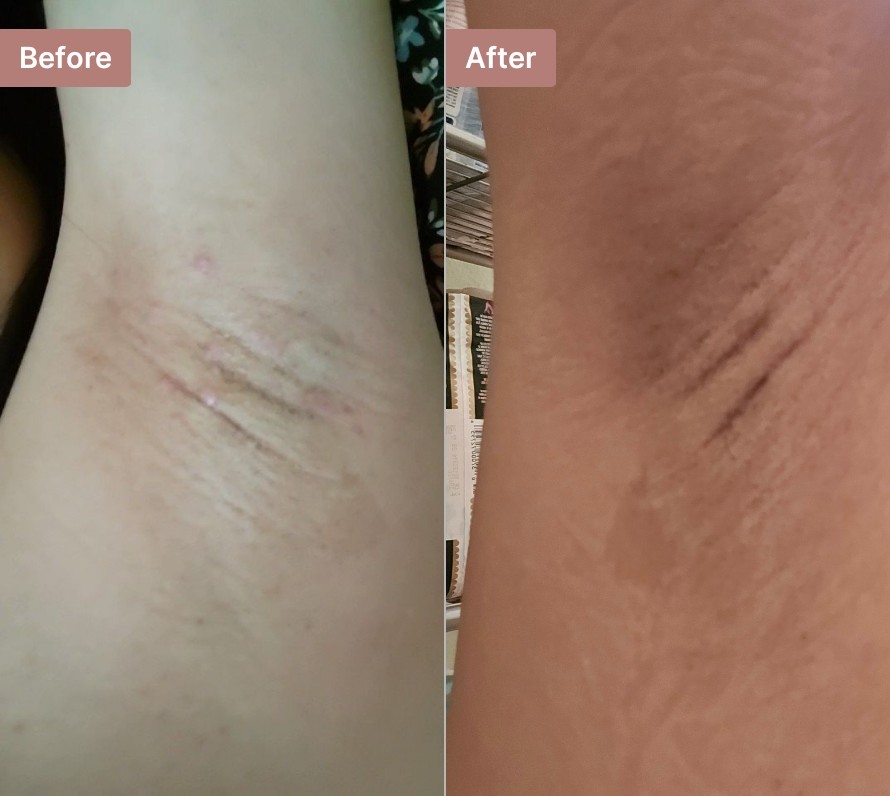 Customer photo