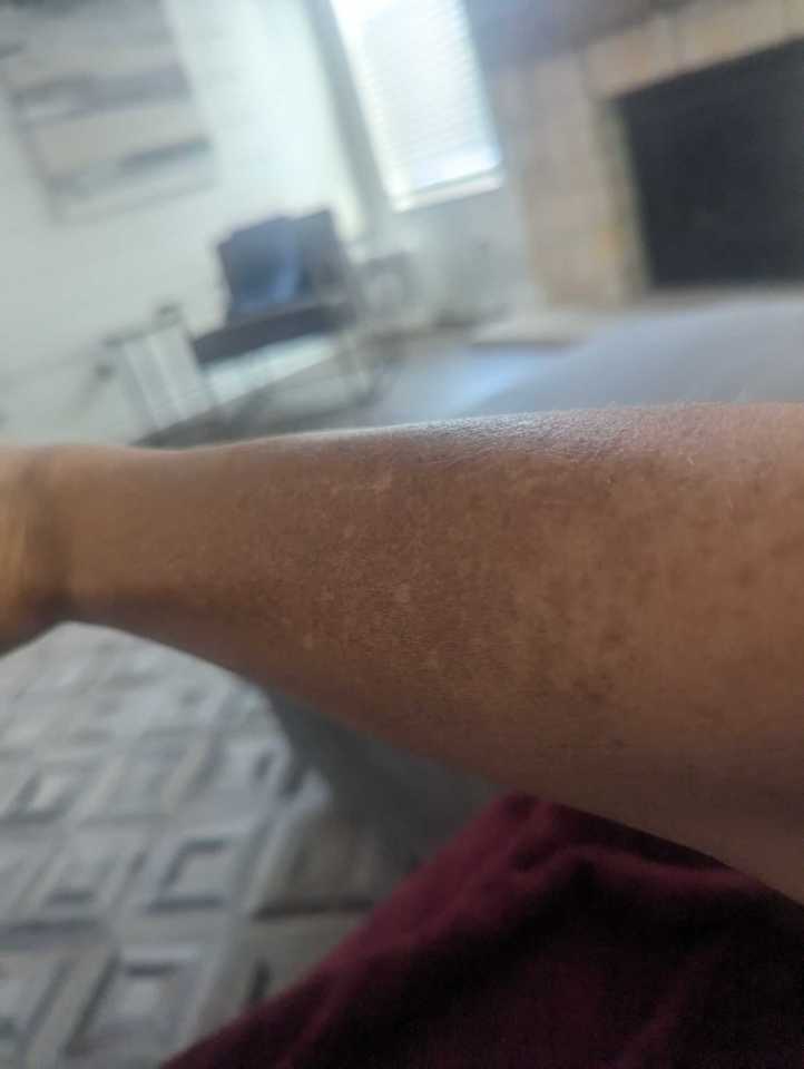 Customer photo