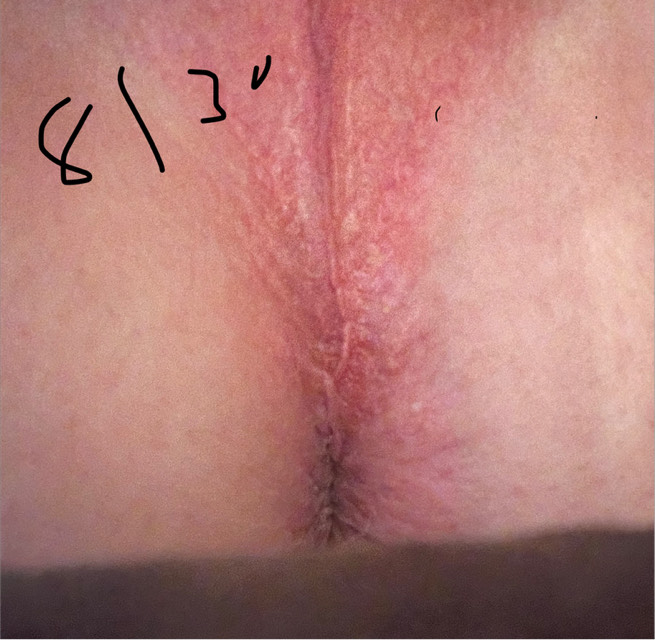 Post attachment 6