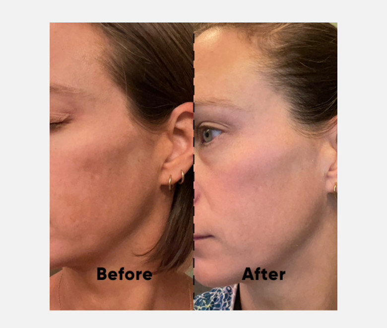 The Spot Cream review photo by Krystal P.