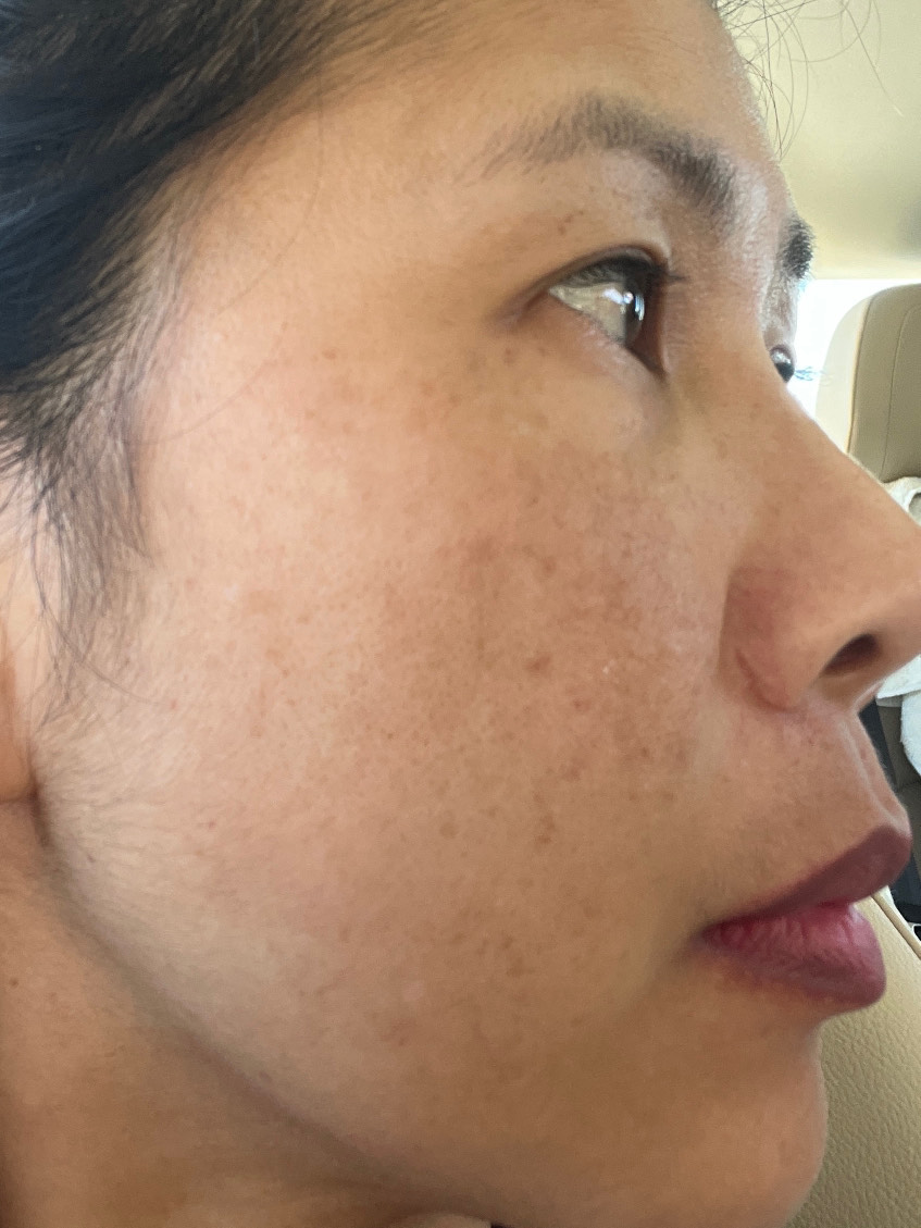 The Spot Cream review photo by Natthacha  B.