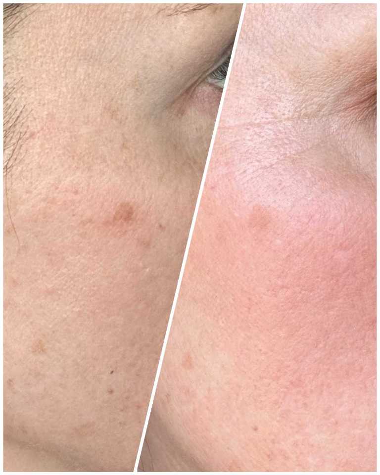 The Spot Cream review photo by Lauren S.