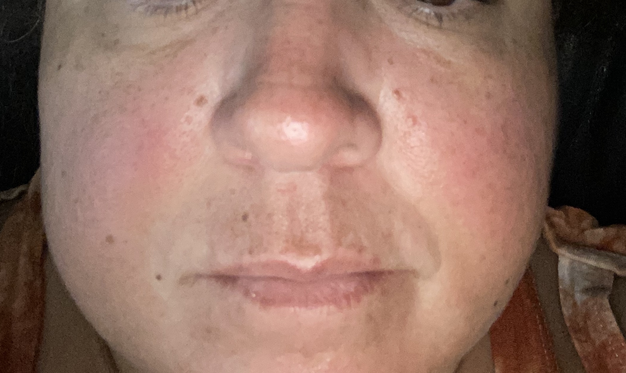 The Spot Cream review photo by olga B.