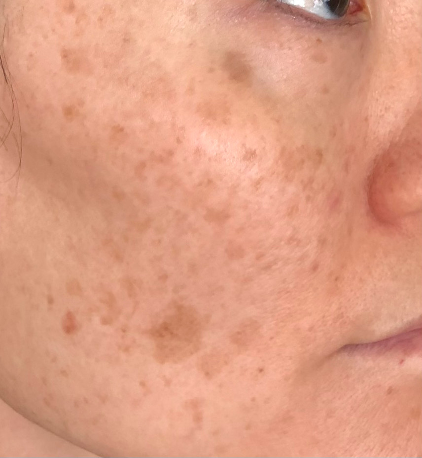 The Spot Cream review photo by Annie S.