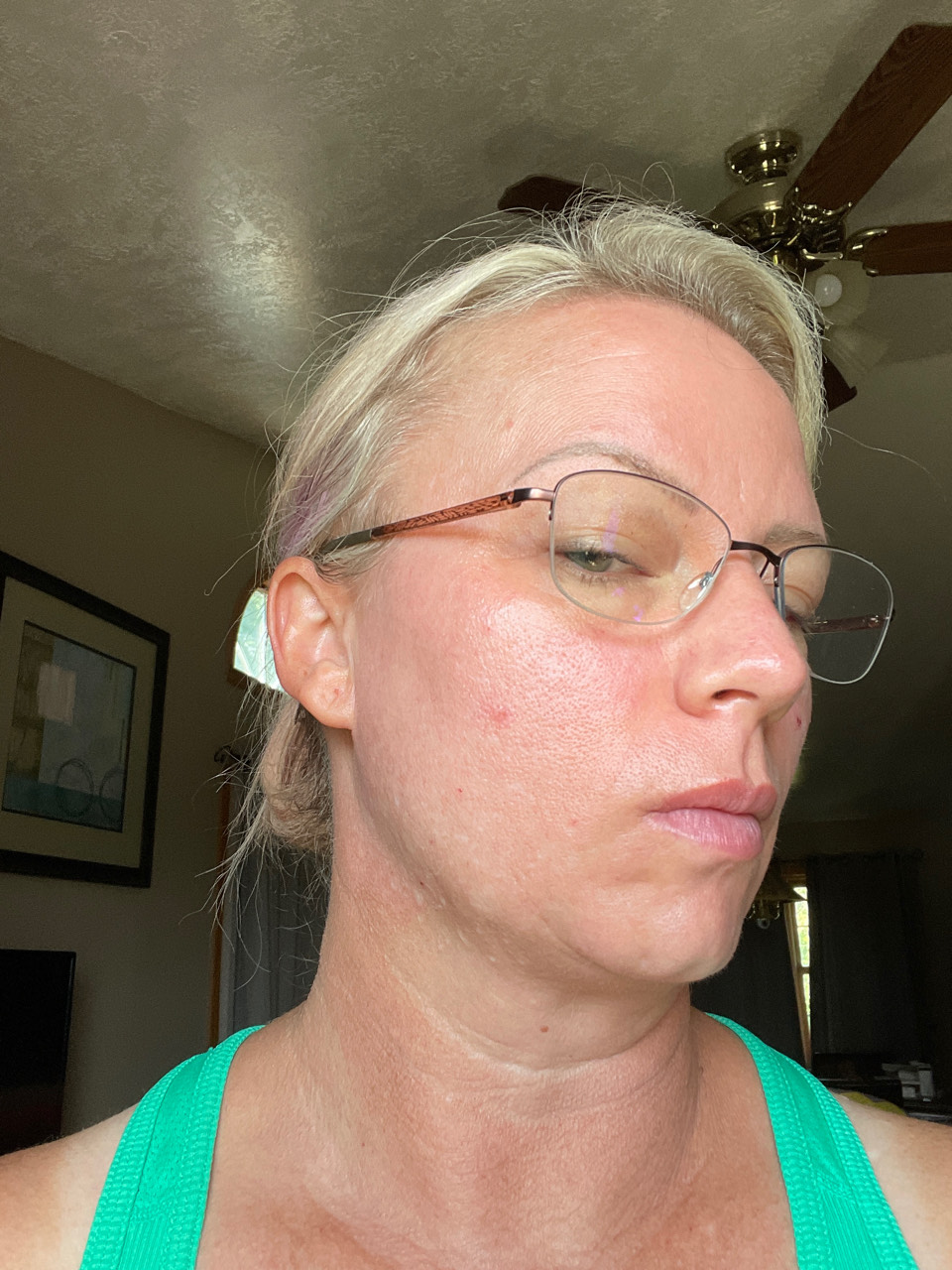 The Spot Peel review photo by Amber H.