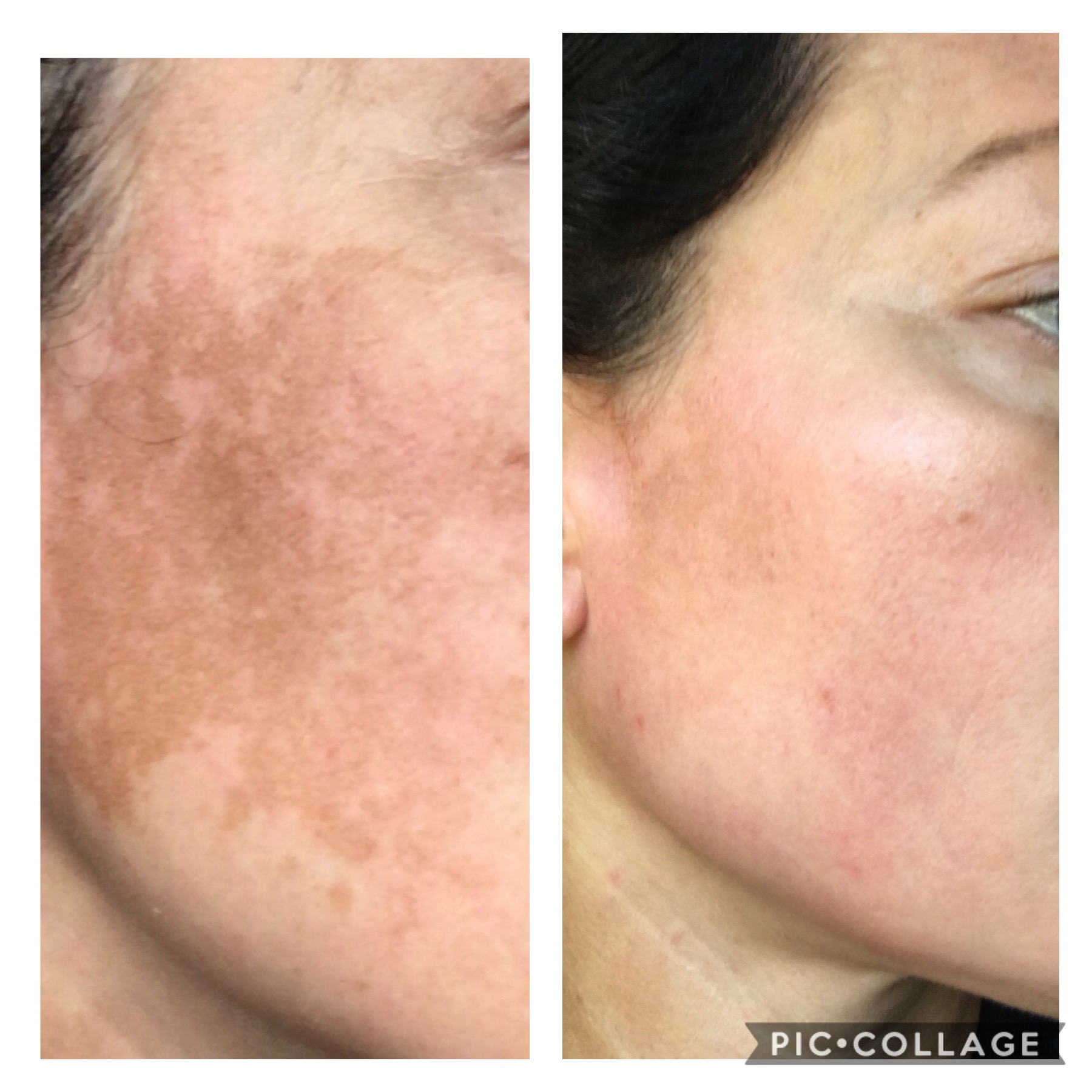 The Spot Cream review photo by Jennifer M.