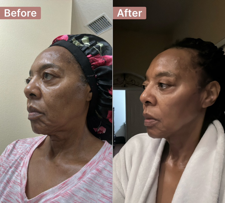The Cell Repair Serum review photo by MARIAN B.