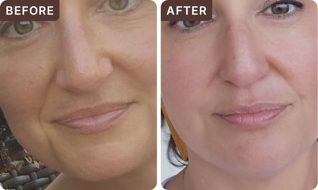 Rishawna G. -- before and after, 8 weeks
