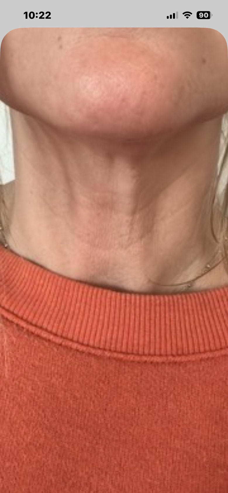 Customer photo