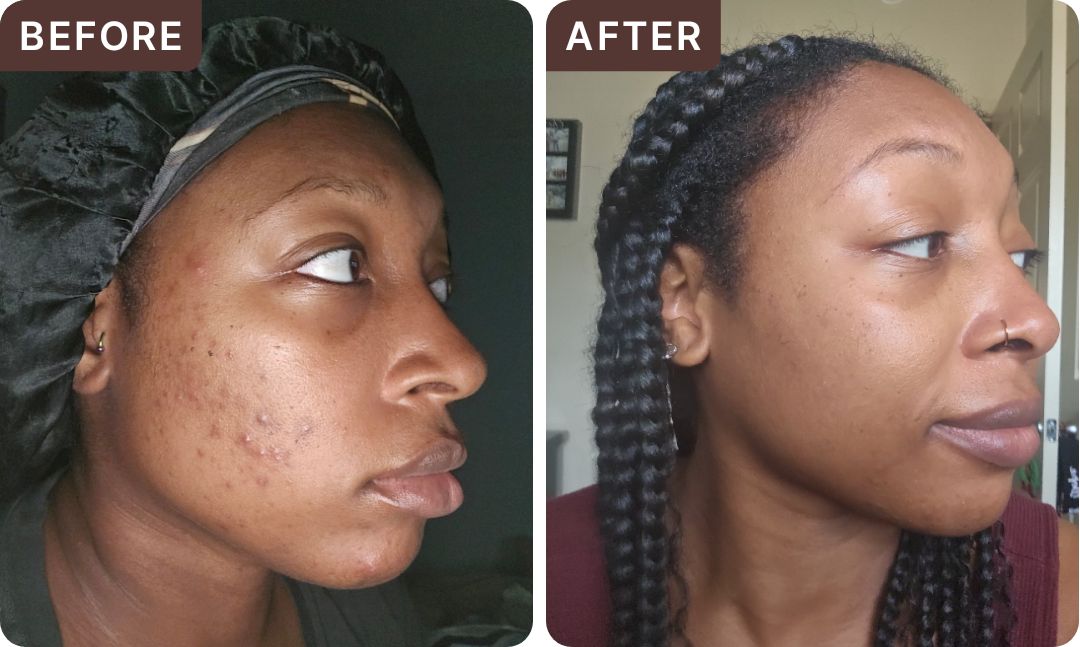 Bria R. -- before and after, 8 weeks