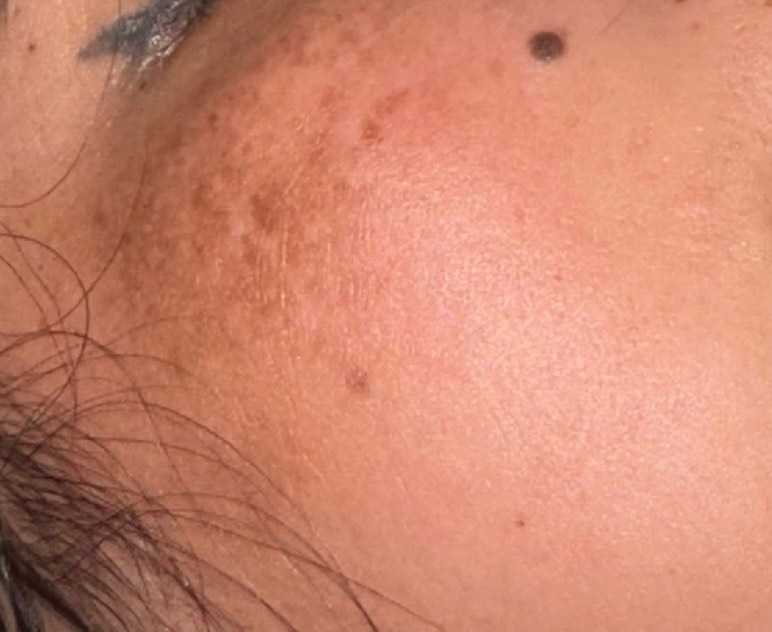 The Spot Cream review photo by Mini P.