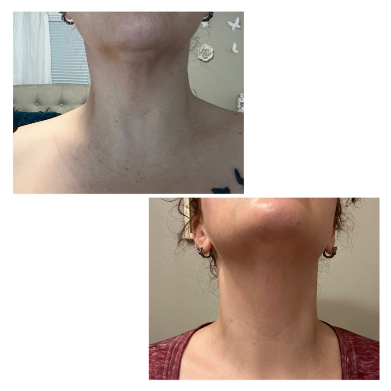Customer photo