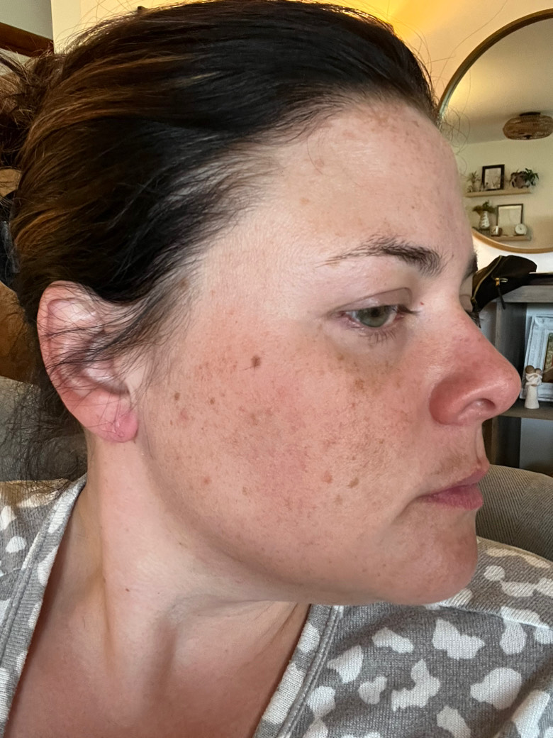 The Spot Cream review photo by Amanda N.