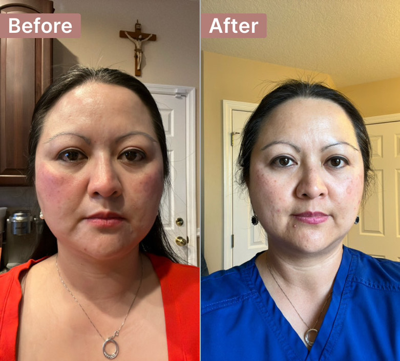 The Spot Cream review photo by Michelle S.