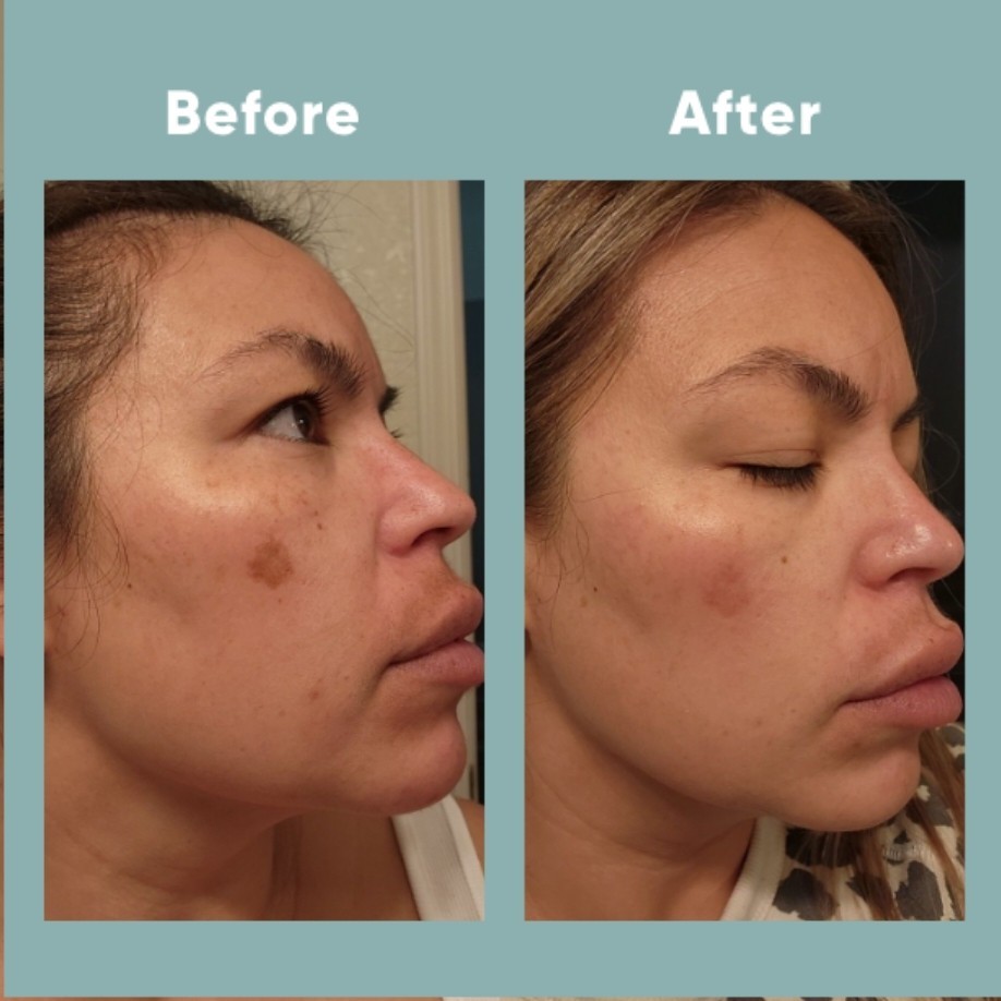 The Spot Cream review photo by Lourdes C.