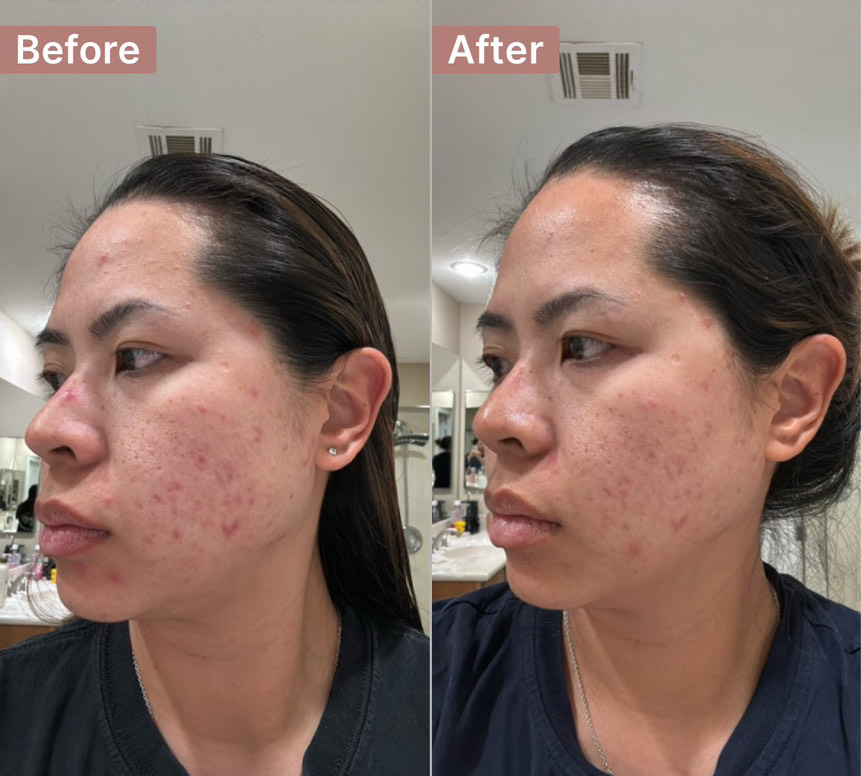The Spot Cream review photo by Alexandra Z.