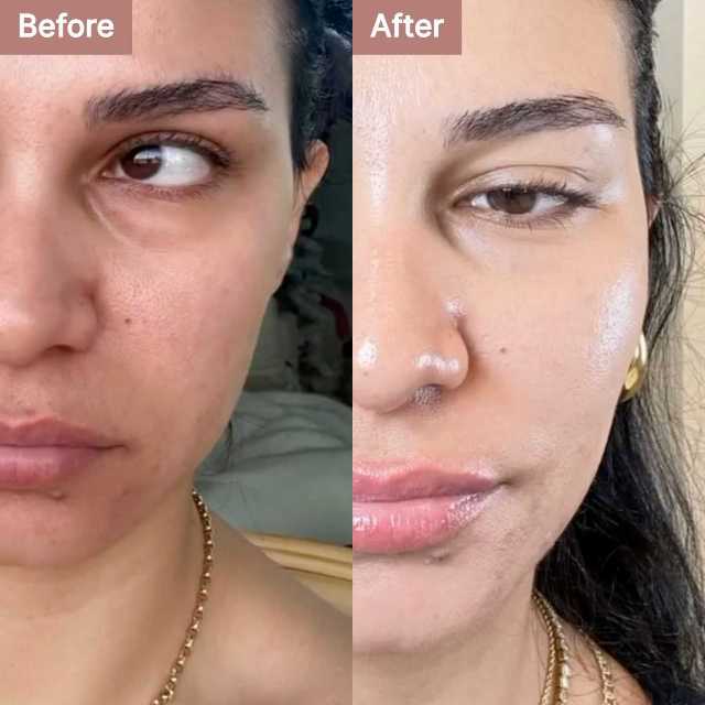 Ozge T. -- before and after, 8 weeks