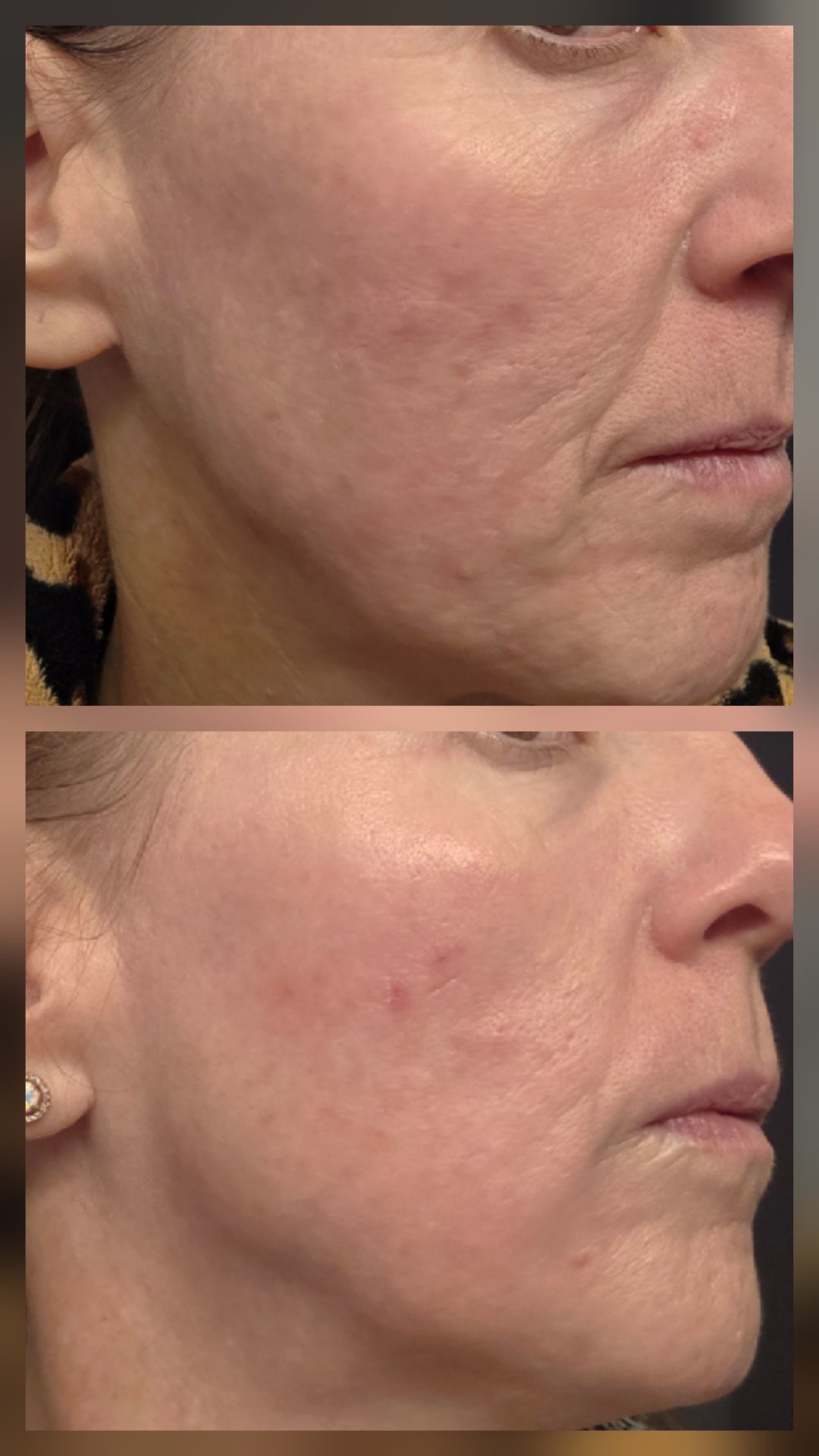 The Anti-Aging Cream review photo by Misheal B.