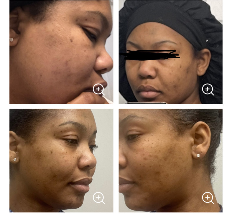 The Spot Cream review photo by Kiana D.