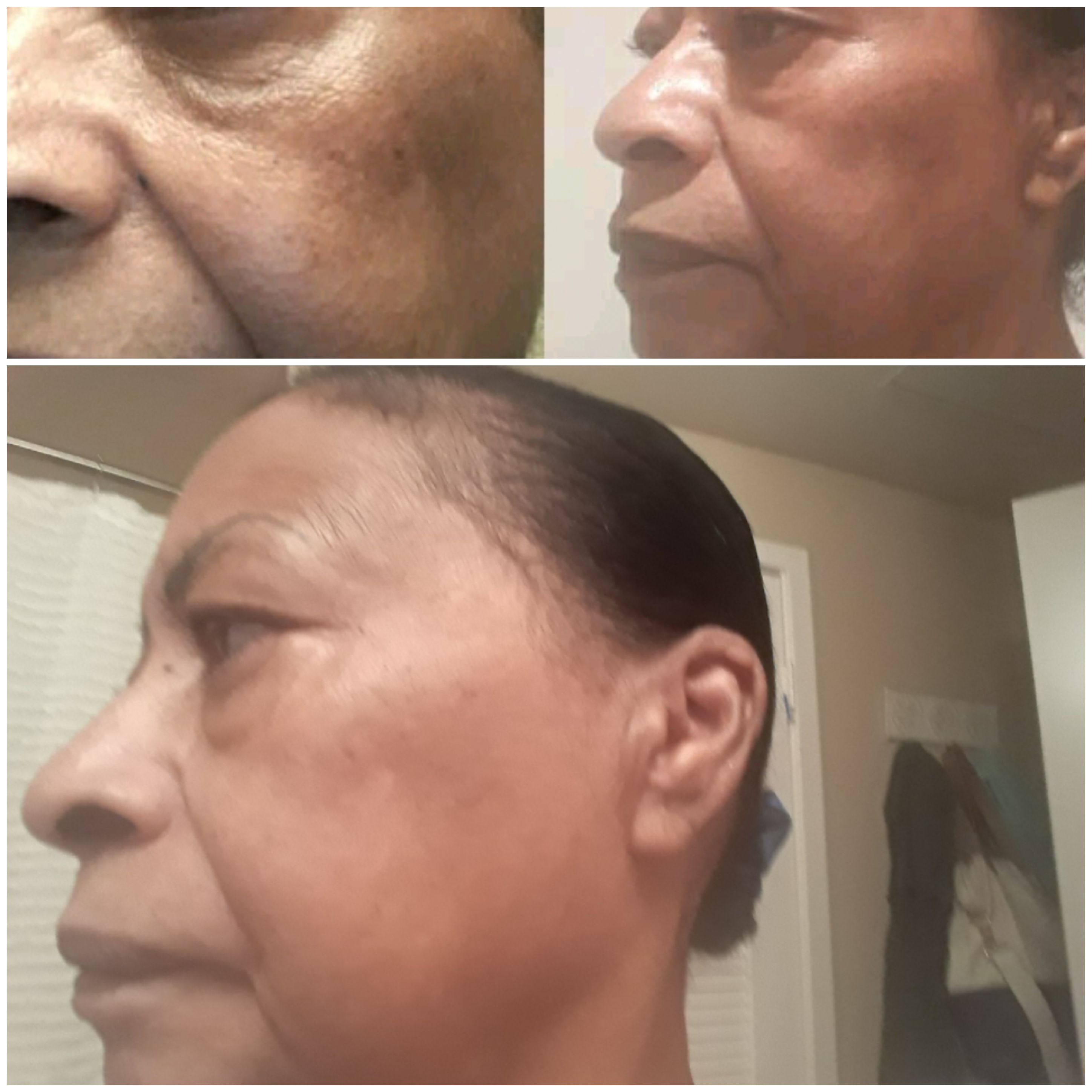 The Spot Cream review photo by Patricia S.