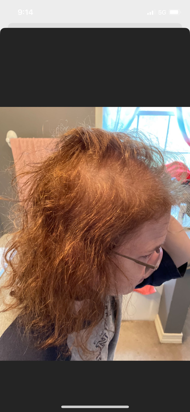 The Hair Pill review photo by Jennifer E.