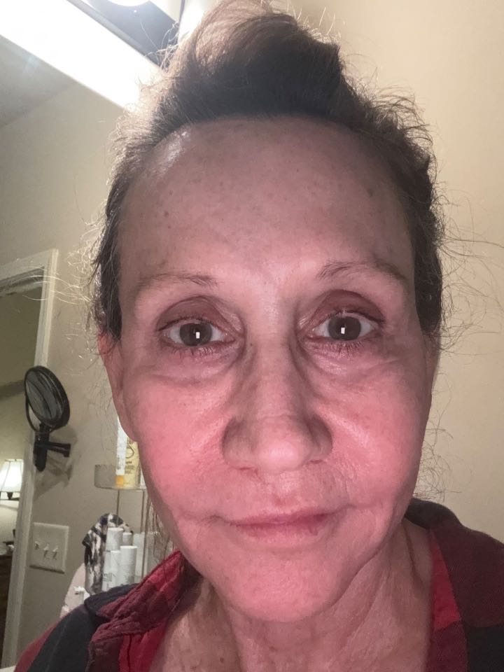 The Eye Serum review photo by Janice H.