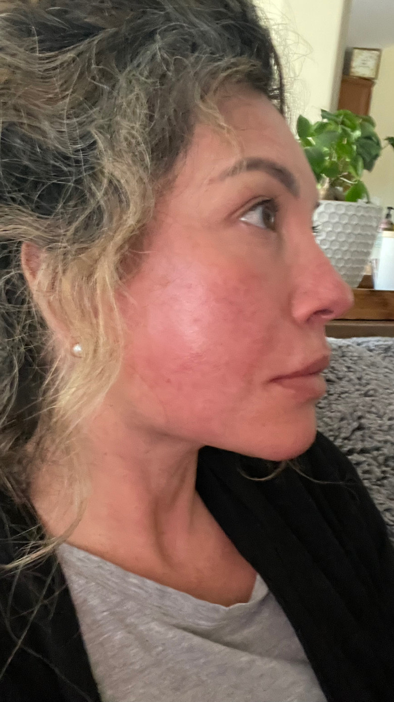 The Spot Cream review photo by Gina C.