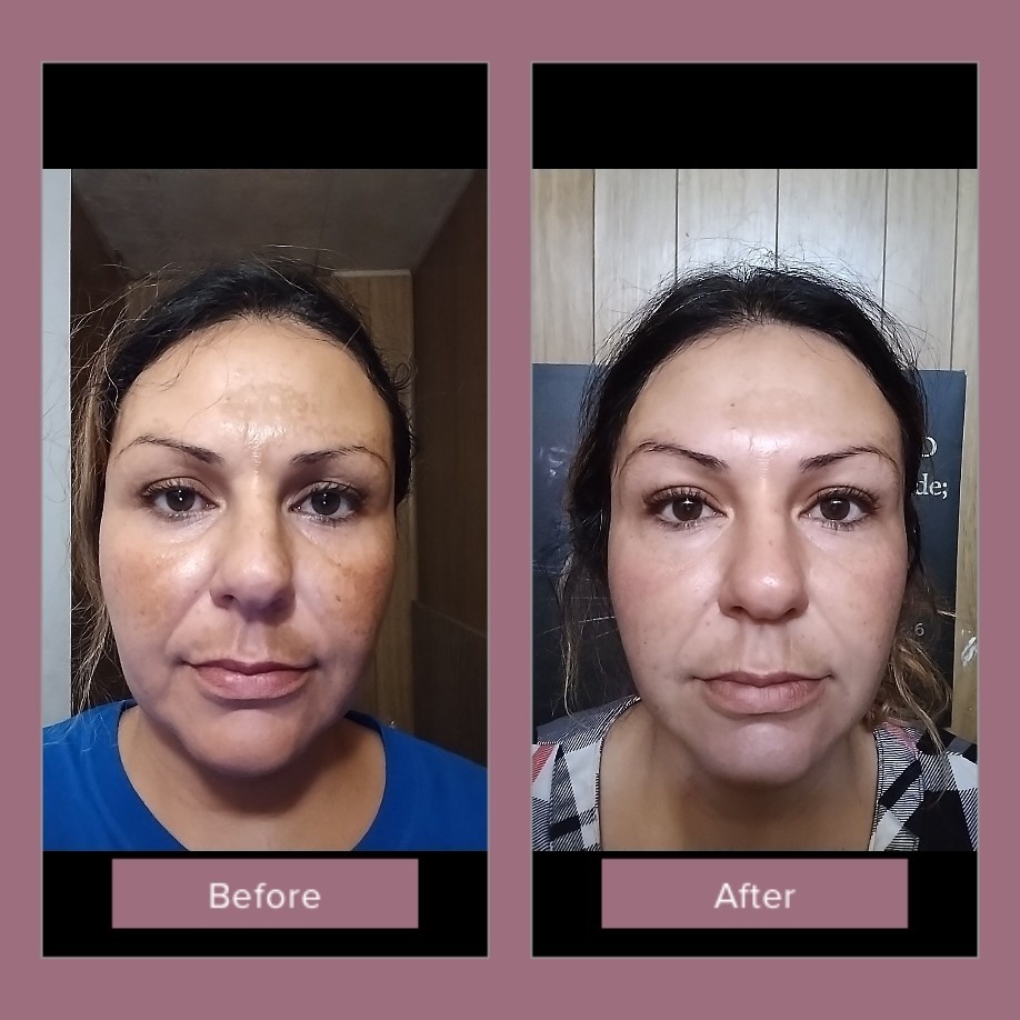 Customer photo